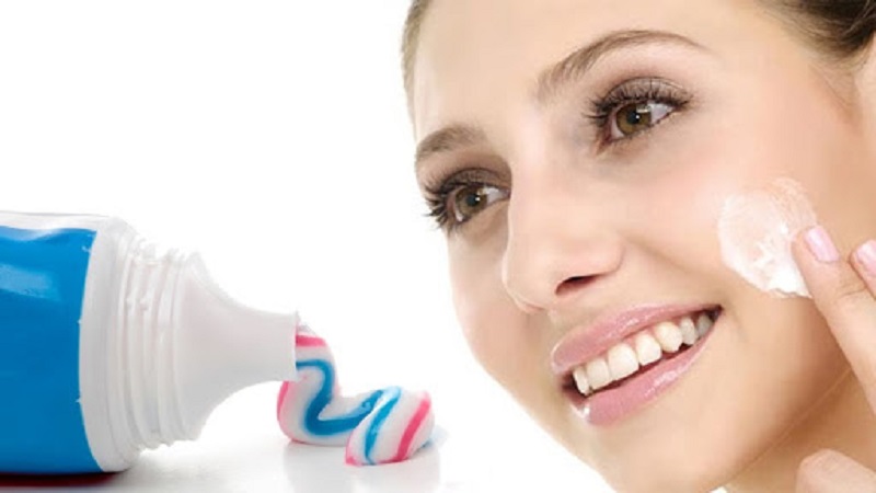 cách trị mụn cám tại nhà bằng kem đánh răng